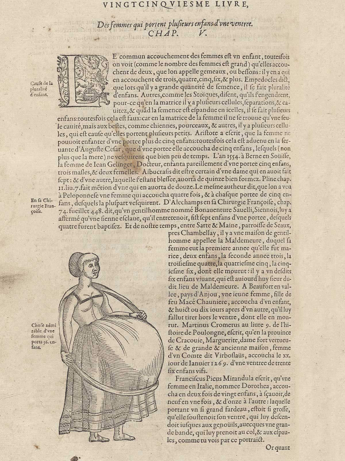 Woodcut of standing facing pregnant woman with large belly facing to the right with a large hoop held behind her shoulders and down below her belly to give it support; with typeset French text to the right of the images; from Ambroise Paré’s Oeuvres, NLM Call no.: WZ 240 P227 1585.