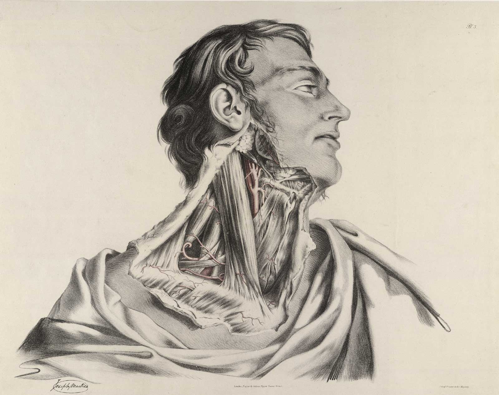 Plate 3 of Quain's The anatomy of the arteries of the human body, with its applications to pathology and operative surgery, featuring the right side view of the flayed body of a male corpse from the collarbone to the ear displaying the muscles, nerves and arteries of the neck.