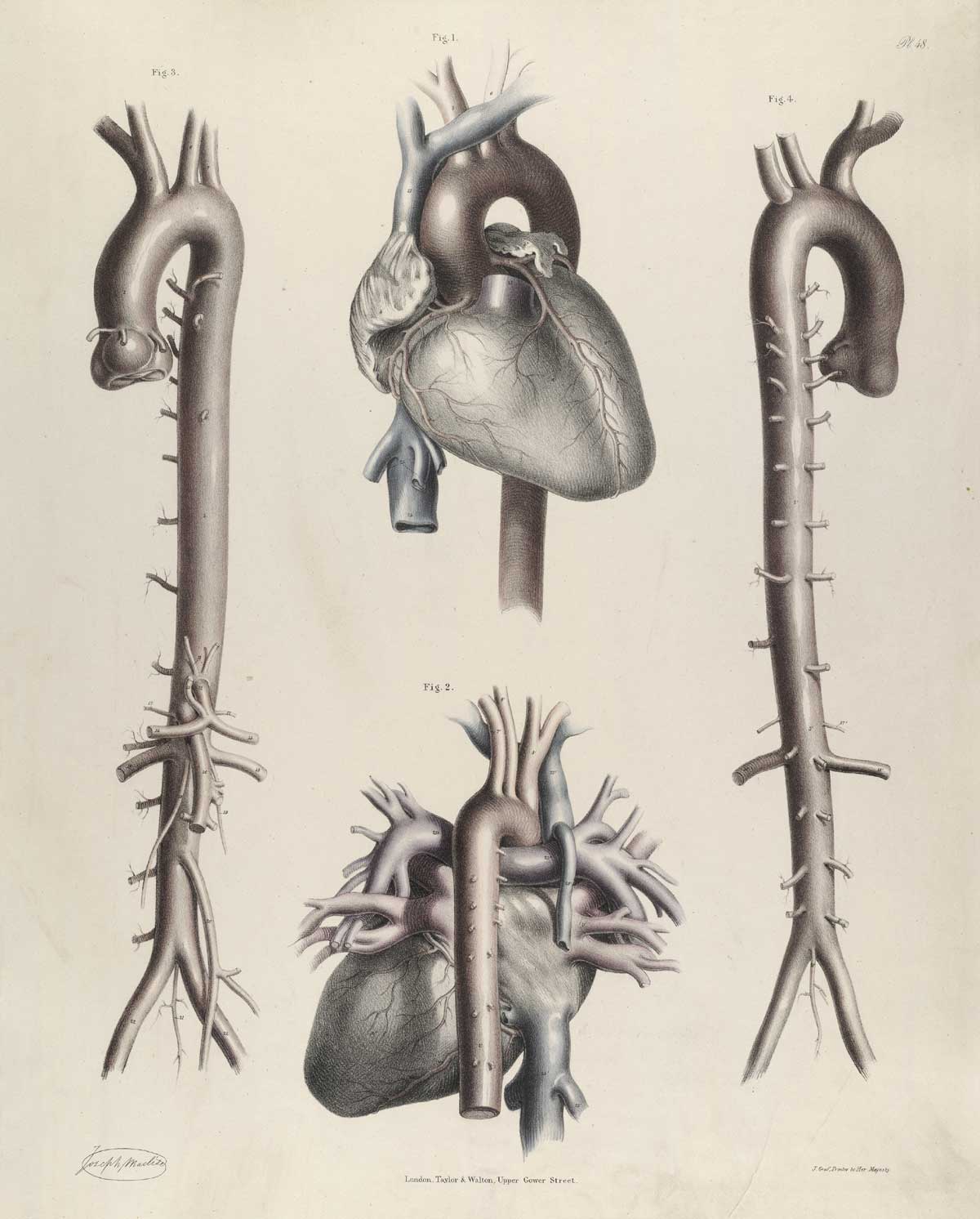 Plate 48 of Quain's The anatomy of the arteries of the human body, with its applications to pathology and operative surgery, featuring four images of the arteries of the heart. Two of the images are of the front and back views of the arteries while the other two images show where the arteries attach to the heart.