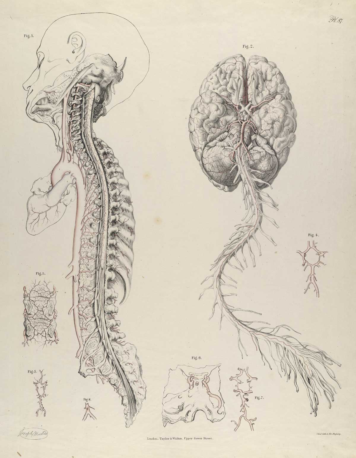 Plate 87 of Quain's The anatomy of the arteries of the human body, with its applications to pathology and operative surgery, featuring multiple views of the arteries leading from the brain to the bottom of the spinal cord.