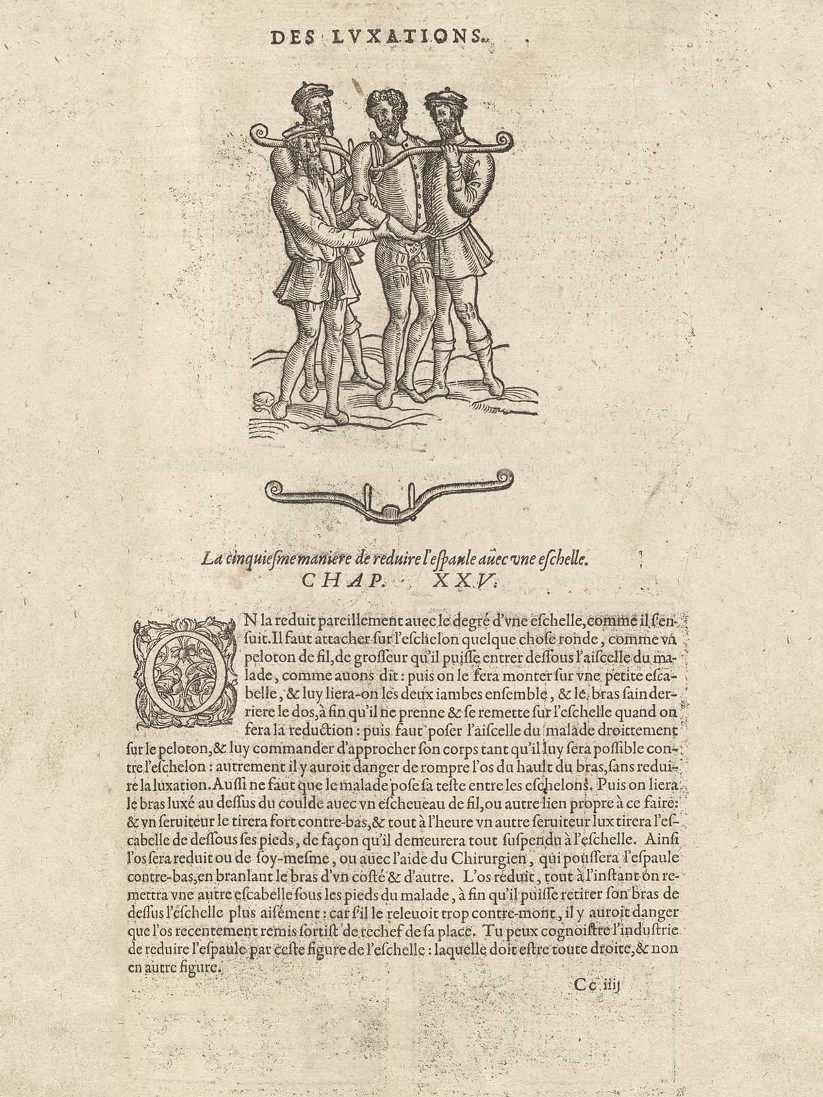 Page VCLXXVII which features three men attempting to repair a shoulder disclocation of a fourth man using a ladder (eschelle) with descriptive text.