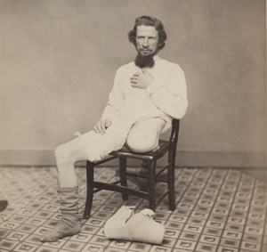 A sepia photograph of Private Lemon, a man whose left leg was amputated at the hipjoint, sitting on a chair.