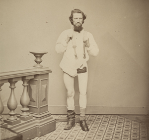 A sepia photograph of Private Lemon, a man whose left leg was amputated at the hipjoint, standing wearing his prosthetic leg.