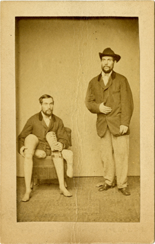 Sepia photograph of a man whose legs were amputated, sitting on a chair holding his artificial limbs, next to another image of him standing, with the prosthetics covered by his clothing.