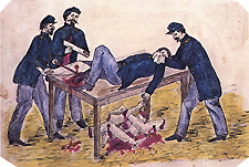 Gruesome color illustration of Union surgeons performing an amputation on a wounded man, who is restrained on a table. A pile of severed limbs lies underneath the table.