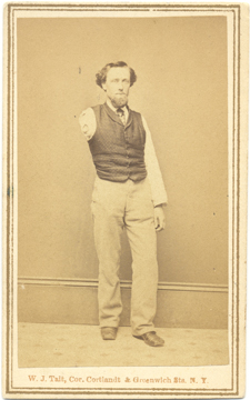 Sepia photograph of a Burritt Stiles, standing wearing pants, a shirt, and a dark vest. His right arm was amputated near the shoulder.