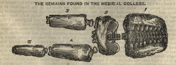 An engraving of skeletal remains found in the medical college, which consists of five large pieces of a body.