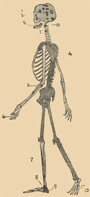 The restoration of Dr. George Parkman's skeleton. (Illustration from Trial of Professor John W. Webster, 1850.).