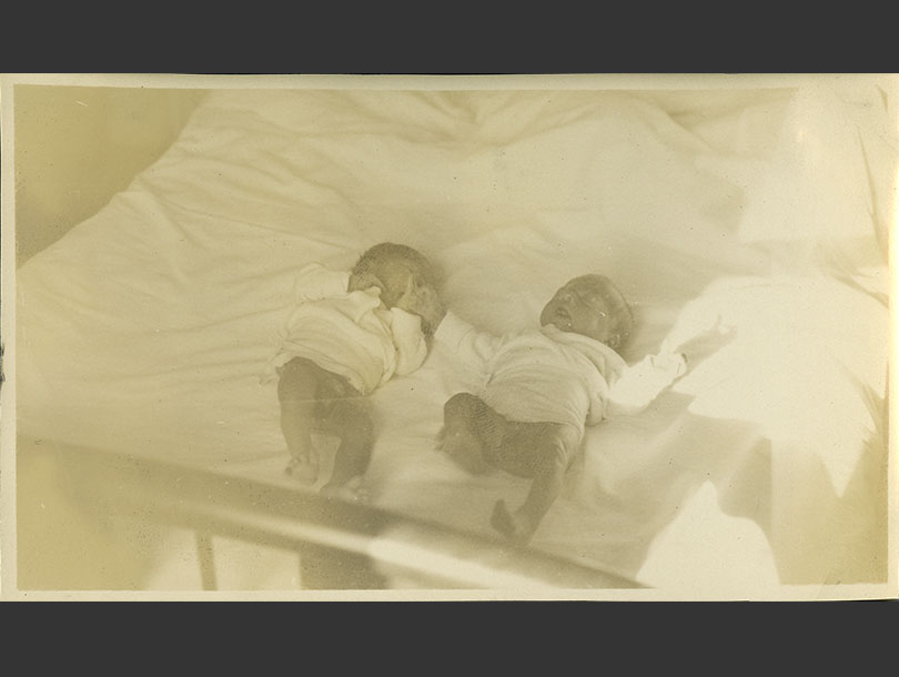 Small newborn twins lying in a bed, legs visible.