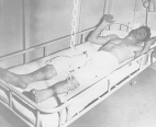 A man lying in a bunk covered in smallpox