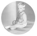 Male toddler seated on the ground wearing only a diaper covered with measles.