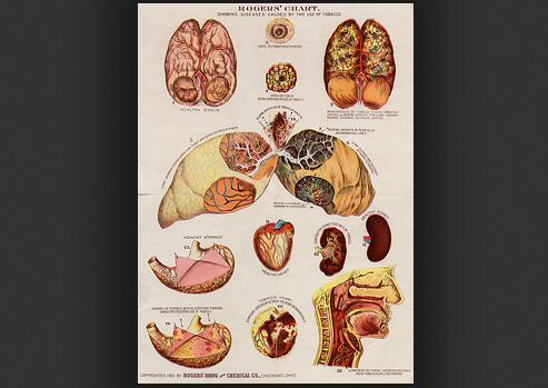 Scientific drawings of the tobacco related diseases effects on the human organs.