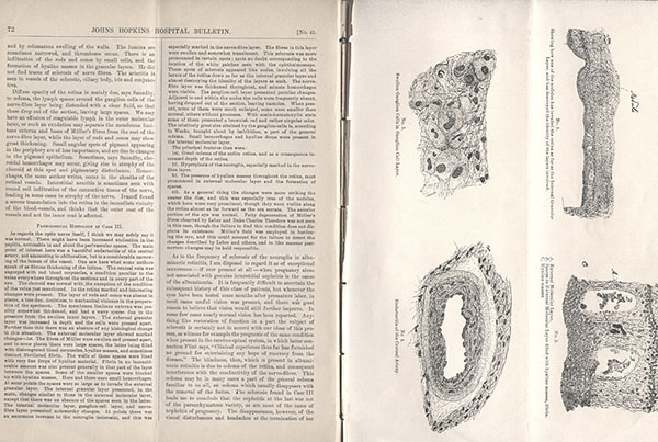 Volume five of the Bulletin of the Johns Hopkins Hospital open to page 72 and 73 featuring an article by Robert Fletcher. On page 73 is an illustration of four views of hematology cells.