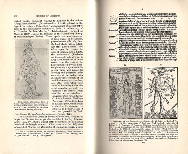 An Introduction to the History of Medicine, with Medical Chronology, Bibliographic Data and Test Questions by Fielding Garrison open to page 134 and 135. On page 134 on the left side is an illustration of a man with zodiac signs drawn over his body. On page 135 are two illustrations on the bottom. The left one is showing the points for blood-letting under the signs of the Zodiac. The right illustration is wound man showing a man with wounds from many different kinds of weapons.