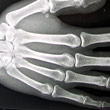 X-ray of hand.