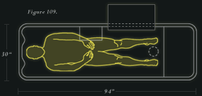 Line drawing of body on autopsy slab table.