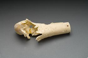 Leg bone from the Ragsdale Gunshot Wound Study, 1984