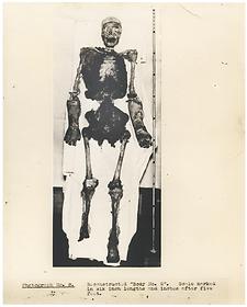 Mrs. Ruxton
Reconstructed body No. 2, 1935