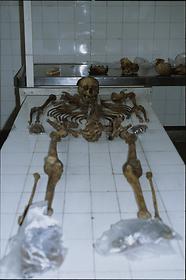 Liliana Pereyra's skeletal reconstruction, about 1985