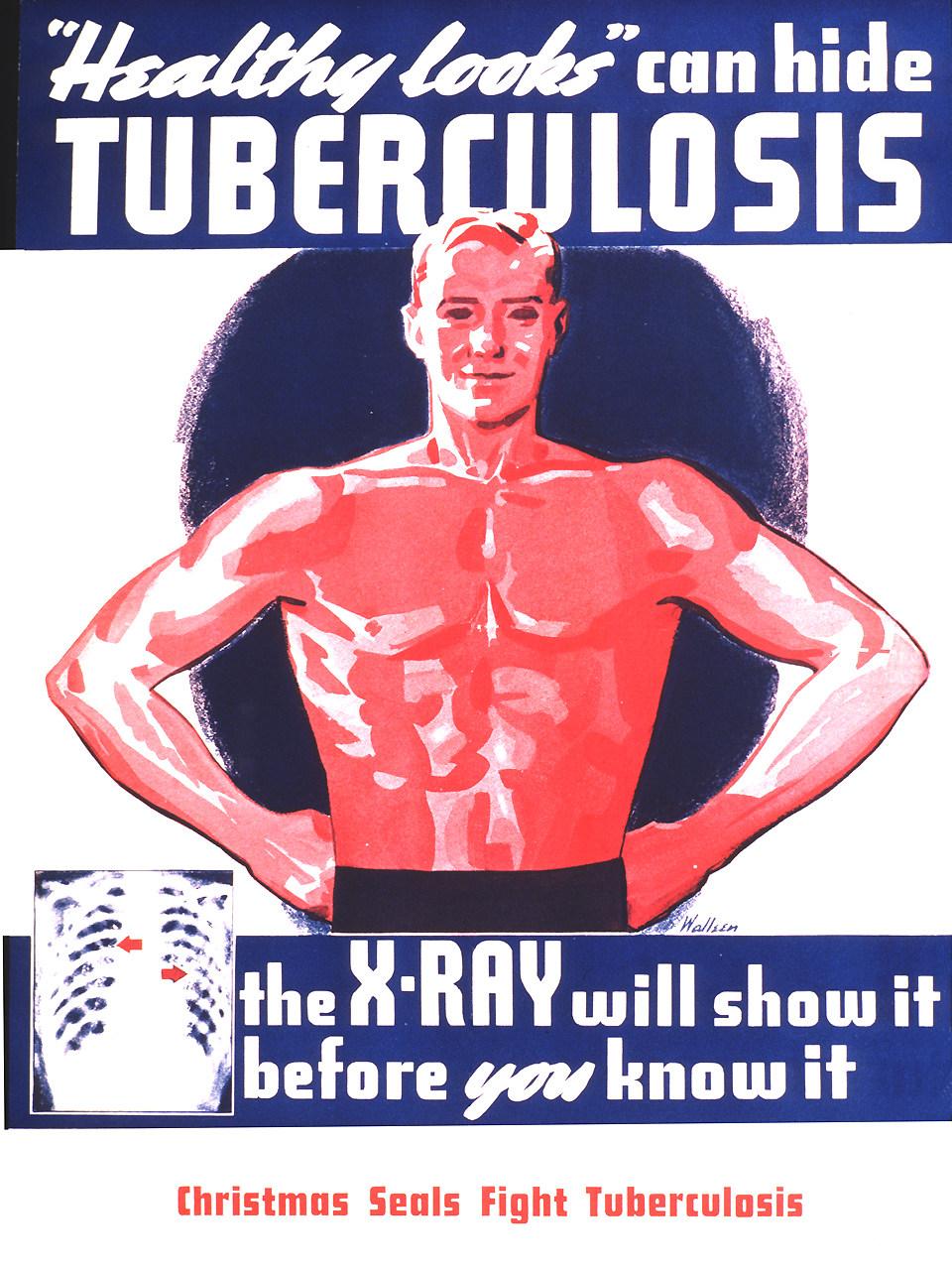 Visual shows a man from the waist up with his hands on his hips. He is bare chested and an x-ray of a chest with a couple of red arrows appears at the bottom left of the poster, beside the second part of the title.