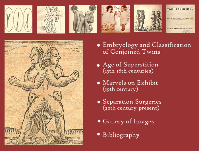Banner containing six icons that link to the individual pages of the website.  From left to right: 1. Image of three embryos, that links to the Embryology page.  2. Image of conjoined twins from a 15th century book, that links to the Age of Superstition page. 3. Image of Millie-Christine McCoy, that links to the Marvels on Exhibit page. 4. Image of Clara and Alta Rodriguez, that links to the Separation Surgeries page.  5. Image of a fine engraving of two sets of conjoined twins, that links to the Gallery of Images page.  6. Image of a title page, that links to the bibliography page.   Below the banner, to the left of the links to each page is a large eighteenth century woodcut illustration of female twins joined at the back.