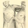 Sketch made by Dr. William Pancoast of the bodies of Chang and Eng Bunker, after their autopsy in 1874.  The autopsy incision and connecting band is clearly seen.