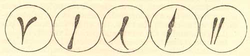 Nineteenth century drawing of 5 embryos of conjoined twins showing the partially separated germ segments.