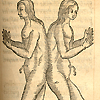 Sixteenth century woodcut illustration of female twins joined at the back.