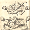 Seventeenth century engraved illustration showing two views of female ischiopagus conjoined twins joined in the genito-urinary area.