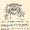 Nineteenth century illustration detailing the peritoneal and hepatic pouches and ensiform cartilages in the connecting band of Chang and Eng Bunker.