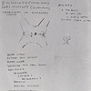 Close-up of Dr. Koop’s whiteboard notes detailing the surgery that will separate the Rodriguez twins.  In addition to a rough diagram showing the shared genitor-urinary area, the notes include the equipment needed for anesthesia and the surgeries; the known surgeries to be performed (cytoscopy, vaginoscopy); the surgical decisions that will need to be made regarding the bladders, rectum, and perineum; and a list of the staff assigned to each twin.