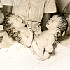 Twentieth century photograph of newborn ischiopagus twin girls being held by a nurse.  The twins are joined at the inferior margins of the coccyx and sacrum and have separate spinal columns.