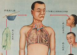 Poster with a main image in the center of a man with diseased lungs, smaller images on the right and left borders show ways to prevent TB, and text below.