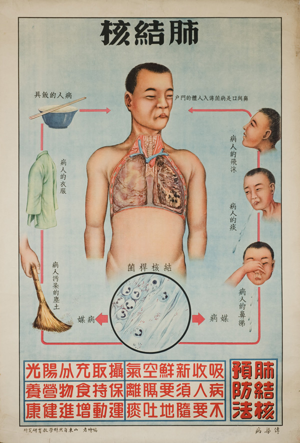 Poster with a main image in the center of a man with diseased lungs, smaller images on the right and left borders show ways to prevent TB, and text below.