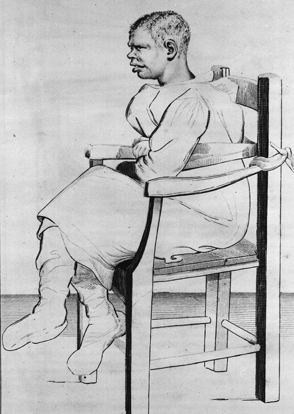 A man is sitting in a chair wearing a gown with the end of each long sleeve tied to the opposite side of the chair.