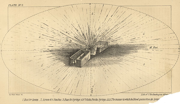 A lithograph of plate number 2 of a murder case. This plate features the illustration the manner in which blood splatters from a syringe placed in a box facing a screen.