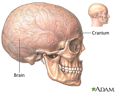 Craniotomy - series: MedlinePlus Medical Encyclopedia diagram of the meninges 