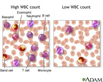 Symptoms of low t cell count