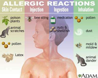Аллергические реакции