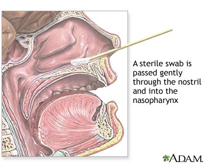 How To Do A Throat Swab 24