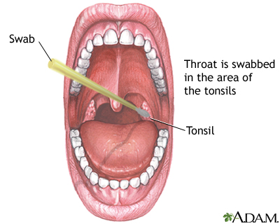 How To Do A Throat Swab 36