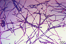 Fotografía de la bacteria Bacillus anthracis visible por tinción de Gram