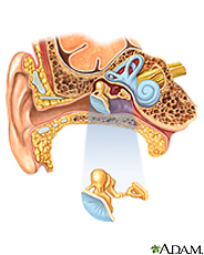 Ilustración del oído y de la anatomía del oído interno