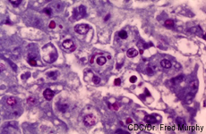Micrografía de infección de hepatocitos por el virus del ébola