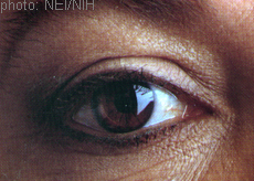 A photograph of an eye