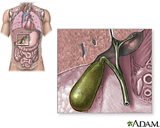Ilustración de la vesícula biliar
