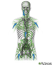 Ilustración del sistema linfático