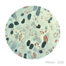 A photomicrograph of Mycobacterium leprae