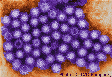 Micrografía de partículas del Norovirus