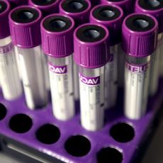 A photo of purple topped vacutainer blood collection tubes